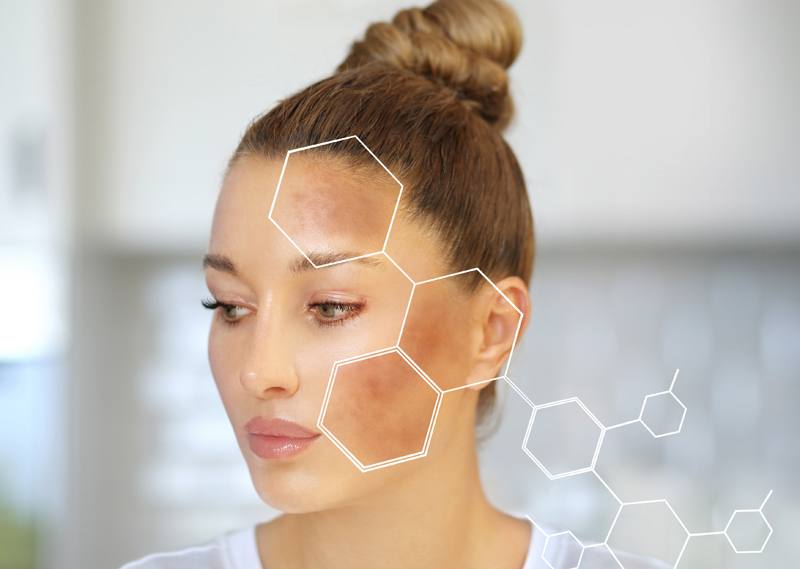 Conférence Esthétique : Les taches pigmentaires : les origines, ses particularités, les traitements, les actifs 