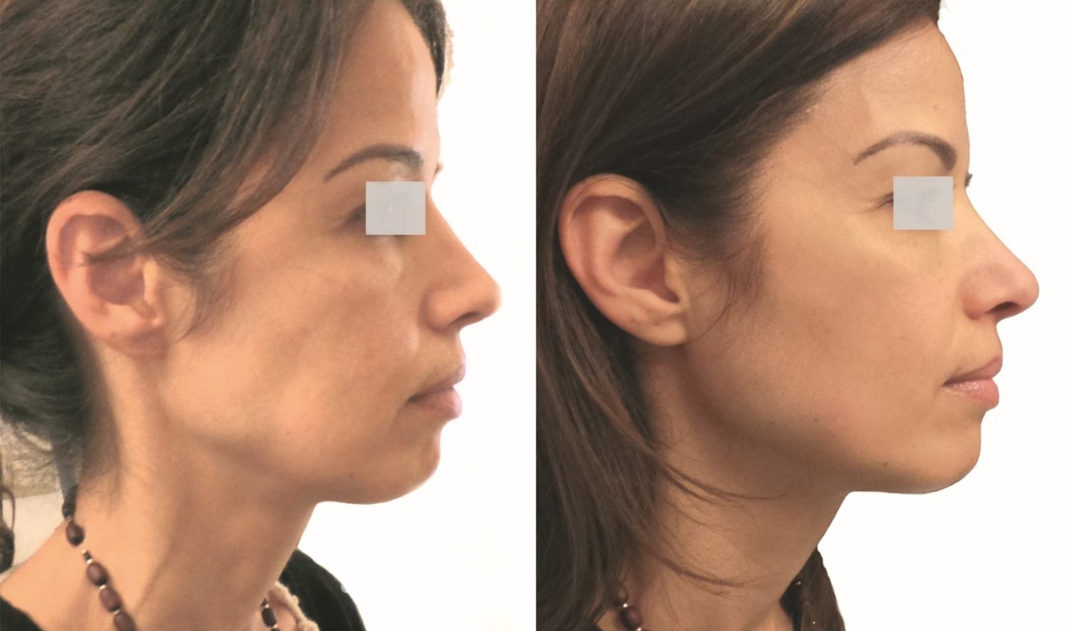 Comment vous différencier immédiatement avec une expertise anti-âge de microcourant révolutionnaire ?